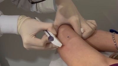 Corbélia passa a oferecer Implanon gratuitamente pelo SUS para mulheres de 14 a 49 anos
