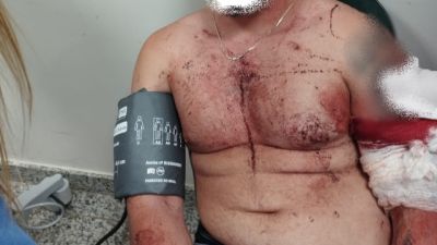 Homem é ferido com arma branca após invadir casa de ex-companheira em Cascavel