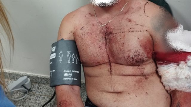 Homem é ferido com arma branca após invadir casa de ex-companheira em Cascavel