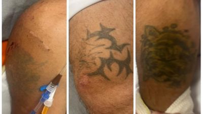 HUOP pede ajuda para identificar homem internado na UTI após queda de altura em Cascavel