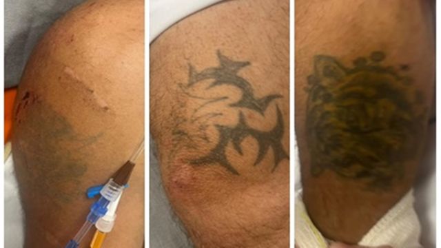 HUOP pede ajuda para identificar homem internado na UTI após queda de altura em Cascavel