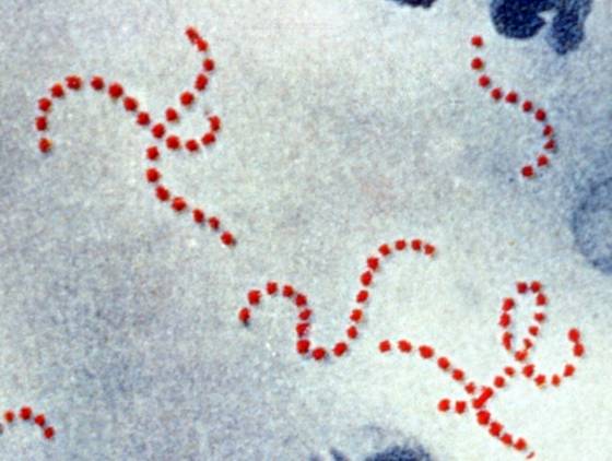 Surto de Streptococcus causa mortes e preocupa moradores da região oeste do Paraná